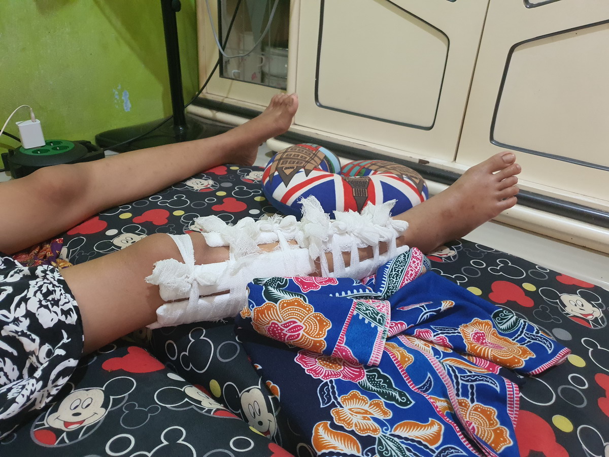 Nestapa Siswi SMP di Tangerang yang Dibully hingga Patah Kaki, Kini Terbaring Lemas